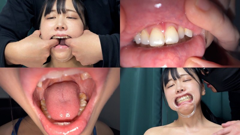 NKO-700001 よだれダラダラすずちゃんの口内観察